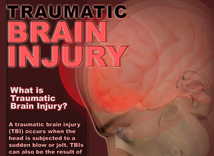 Brain injury thesis