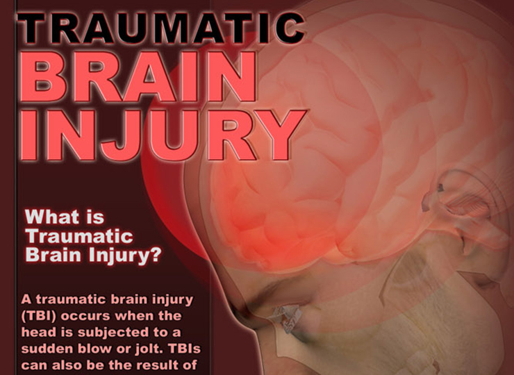 Research papers on brain injury