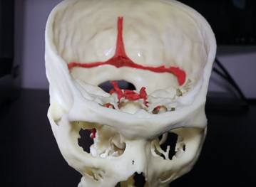 image of a 3d printed skull