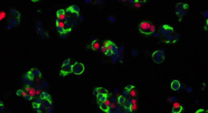Image of insulin cells