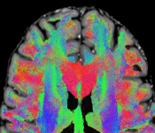 Neuroscience image
