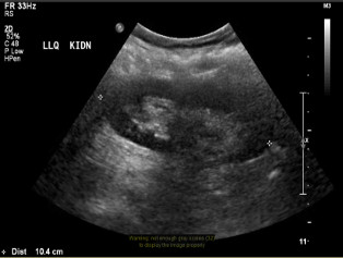 Various ultrasound images
