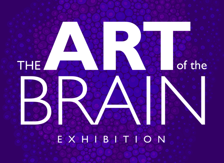 Art of the brain exhibition flyer