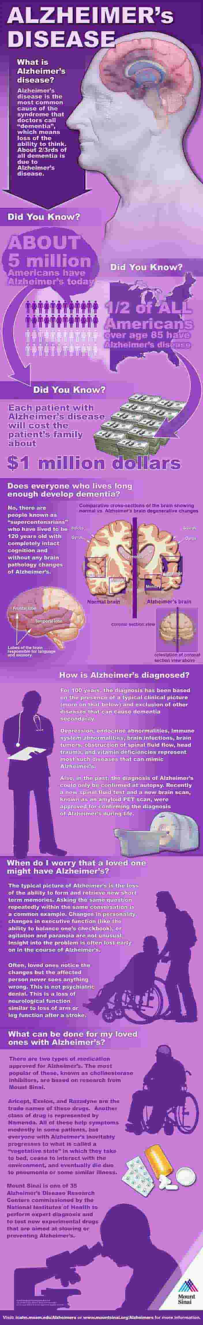 Alzheimer's Disease Infographic