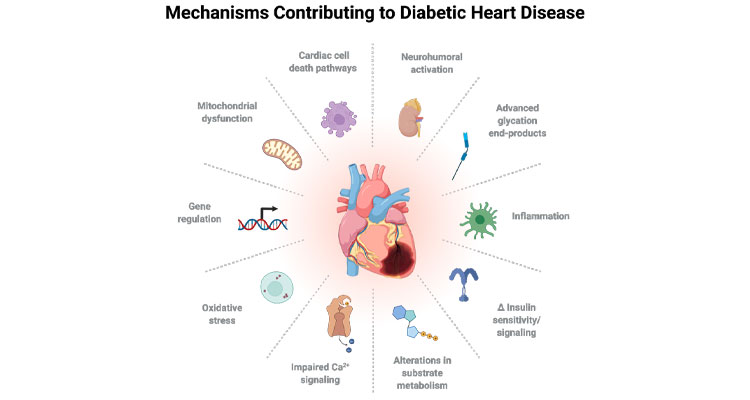 contributions to diabetic heart disease graphic 