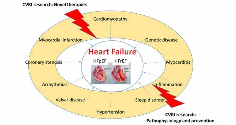 Heart failure graphic