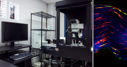 At left is Olympus multiphoton. At right is an image of a tendon labeled for actin (red) and nuclei (green) and imaged or collagen by second harmonic generation (blue) by Stephen Ros.