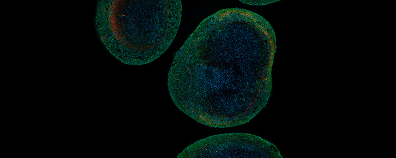 Phd Program In Neuroscience Icahn School Of Medicine