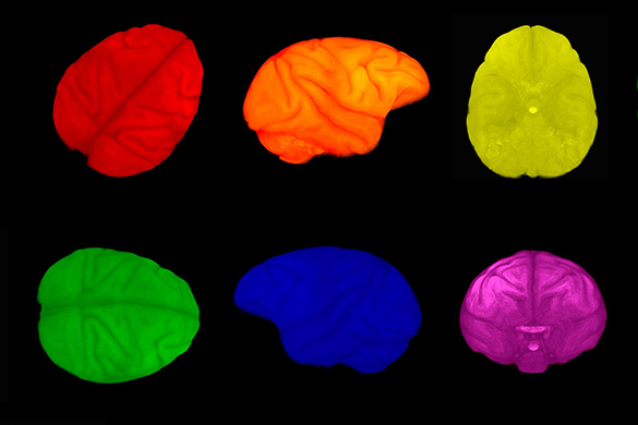 Colorful brain scans