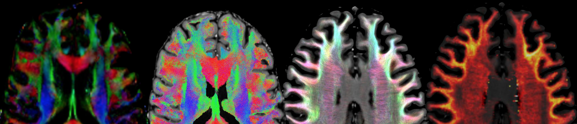 The 2015 Ucla Advanced Neuroimaging Summer Program Day 8 Youtube