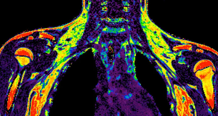 Human Metabolism image