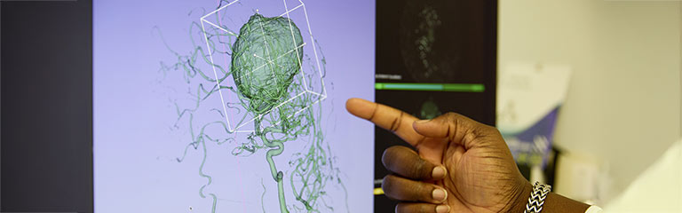 Mssm Design Mount Sinai BioDesign Technology Pipeline | Icahn School of Medicine