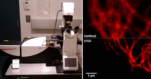 Inverted microscope system